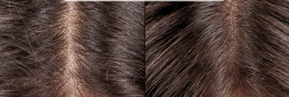 Scalp before and after using the Filtered Showerhead
